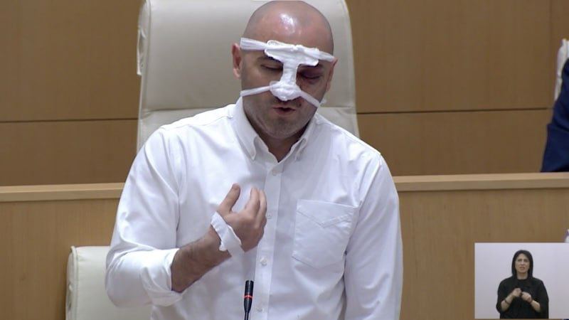 In Tbilisi, security forces brutally beat the leader of an opposition party